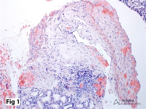 Congo Red Stain | Teaching Points | Arkana Laboratories