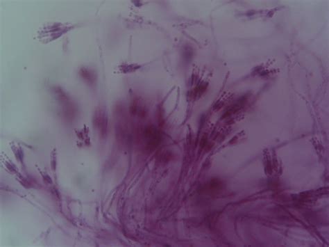 Penicillium - Wikipedia