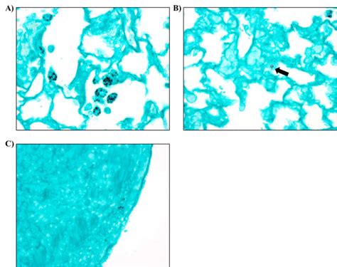 Figure 9, [Images of Fungal Spores Observed...]. - NTP Technical Report ...