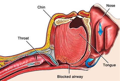 How to Perform a Jaw Thrust And Modified Jaw Thrust?