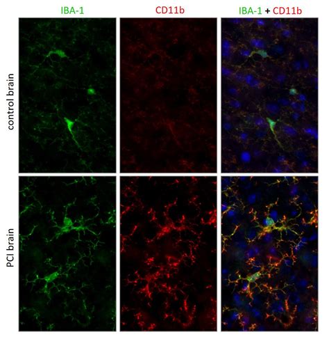 CD11b - a marker of activated microglia