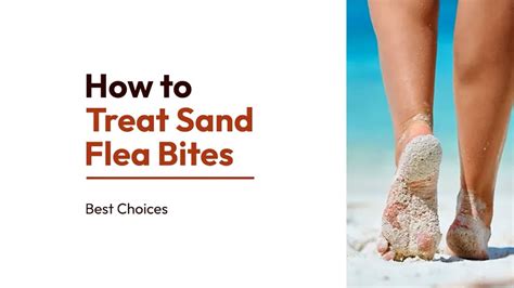 Sand Flea Bites Treatment