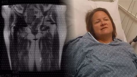 DePuy Hip Implant: Durham woman says metal hip implant caused lifelong ...