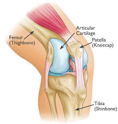 Patellar (Kneecap) Fracture | Boston Medical Center