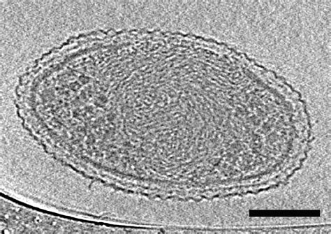 First detailed microscopy evidence of nanobacteria at the lower size ...