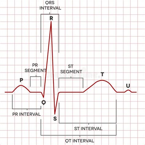 Human Heart Normal Sinus Rhythm, Electrocardiogram Stock Vector ...