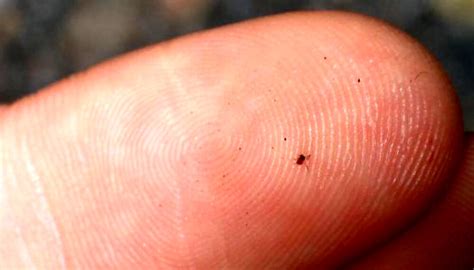 How To Steer Clear Of Chiggers And Enjoy The Outdoors | Off The Grid News