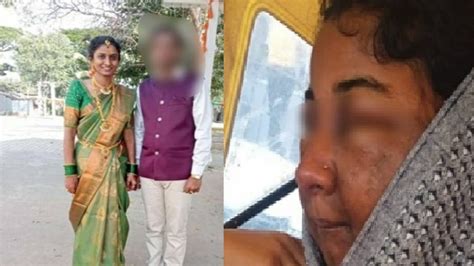 Karnataka bride's face disfigured after makeup, beautician detained for ...