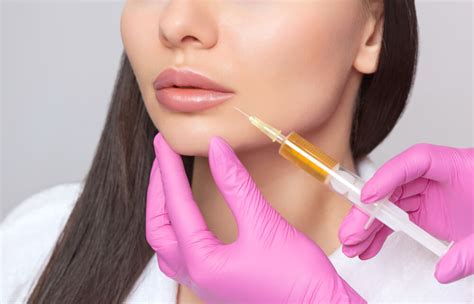 Dermal Filler Lip Injections - National Laser Institute Medical Spa