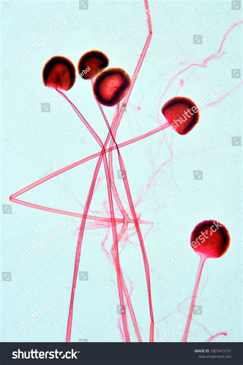 Rhizopus Sporangia Under Microscope Stock Photo 1007415151 | Shutterstock