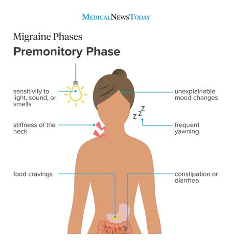 Stages Of A Migraine