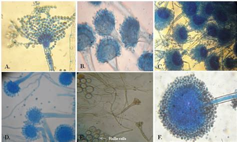 Aspergillus Microscopic View