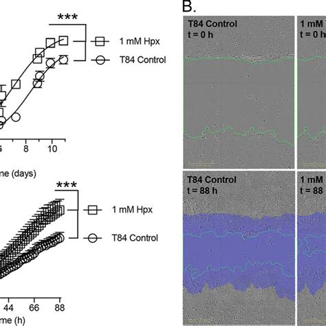 Metabolite responses to hypoxanthine supplementation. A, metabolite ...