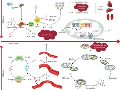 The pathogenesis of ischemia-reperfusion injury on oxidative stress ...