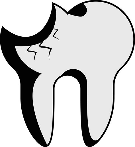 Cracked Tooth Symptoms: Causes, Diagnosis, and Treatment