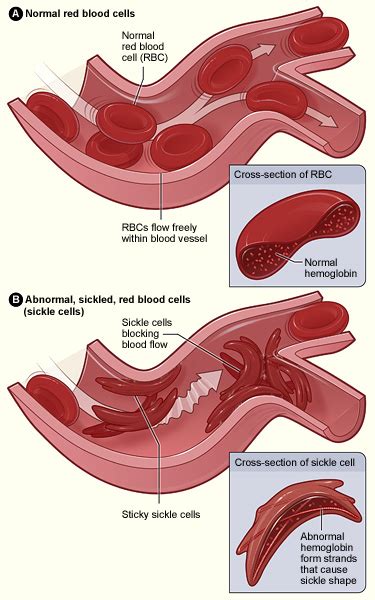 Blood - WikiLectures