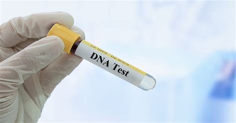 Five things you need to know before you take a home DNA test