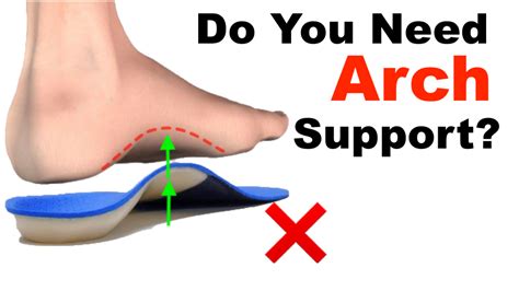 Should You Wear Arch Support? (The TRUTH Behind Orthotics) – Squat ...