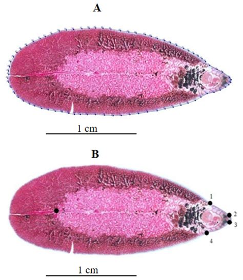 Fasciola Hepatica Slide