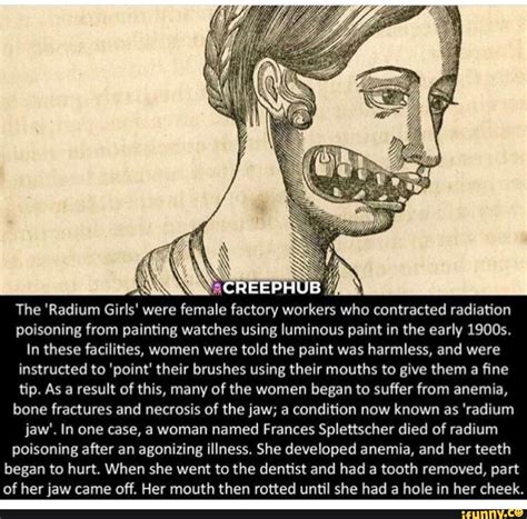 AN SCREEPHUB The 'Radium Girls' were female factory workers who ...