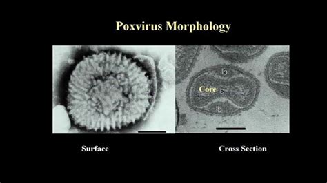 Poxviridae - YouTube