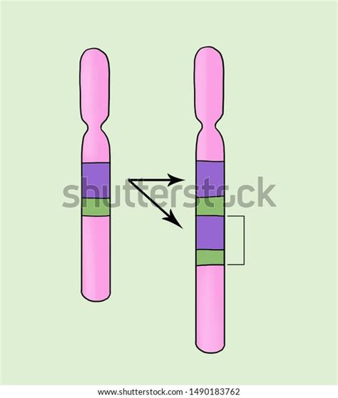 Gene Duplication Sample Chromosome Abnormalities Deletion Stock ...