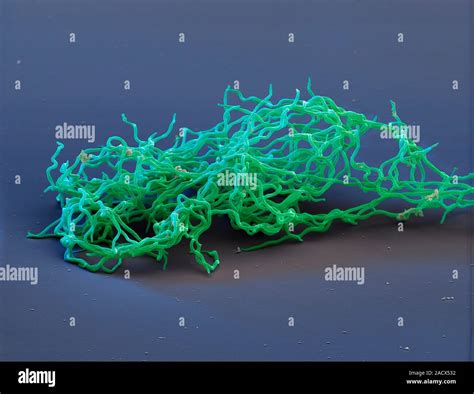 Lyme disease bacteria. Coloured scanning electron micrograph (SEM) of ...