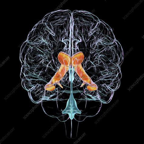 Lateral brain ventricles, illustration - Stock Image - F040/4189 ...