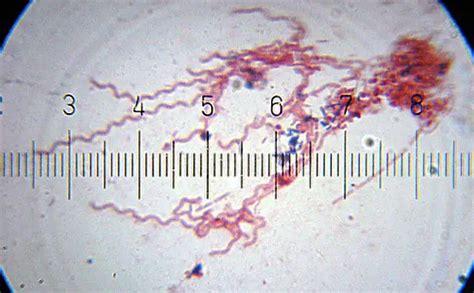 Spirochetes - Definition, Characteristics, Gram Stain and Culture