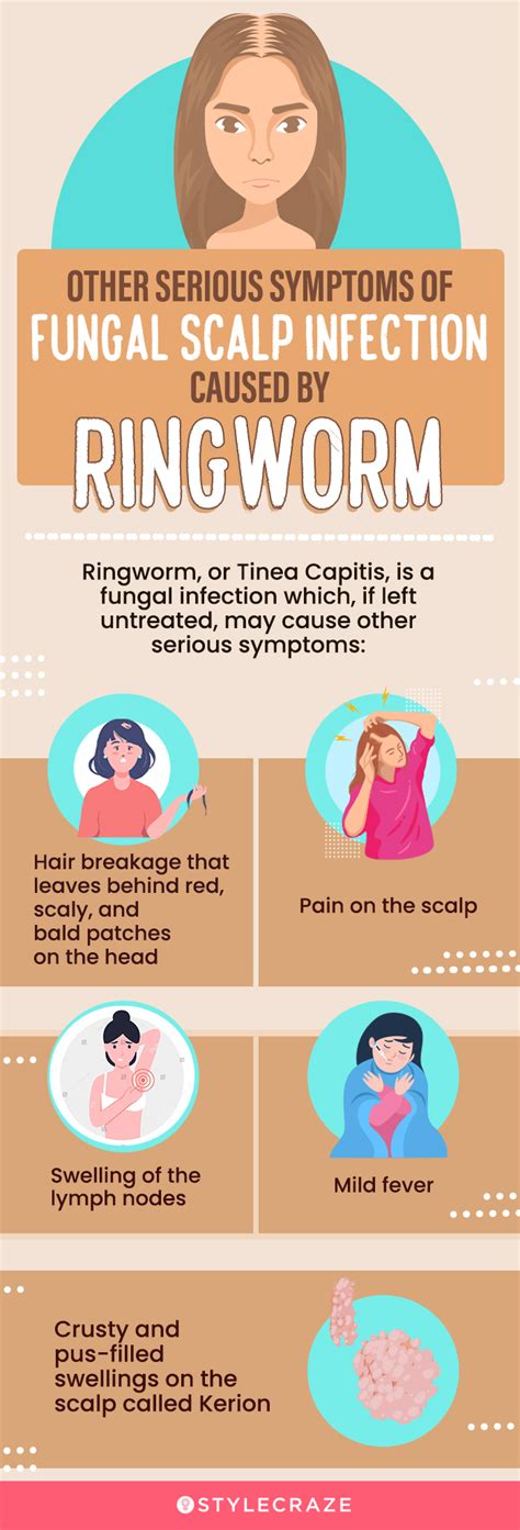 8 Home Remedies To Get Rid Of Scalp Fungus & Prevention Tips