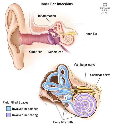 Top 18 what happens when ear infection spreads head 2022