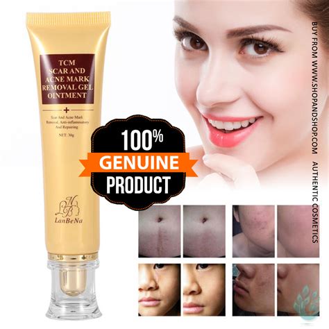 Lanbena Acne Scar Removal Cream Skin Repair Face Cream Acne Spots Acne ...