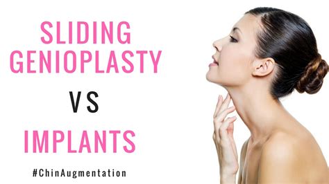 Sliding Genioplasty vs. CHIN IMPLANTS - YouTube