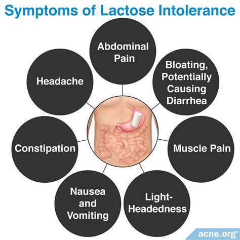 Does Lactose Intolerance Relate to Acne? - Acne.org