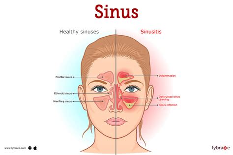 Nose And Paranasal Sinuses Anatomy Elab