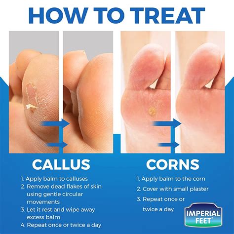 Corn Foot Removal