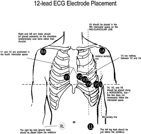 Ecg Leads