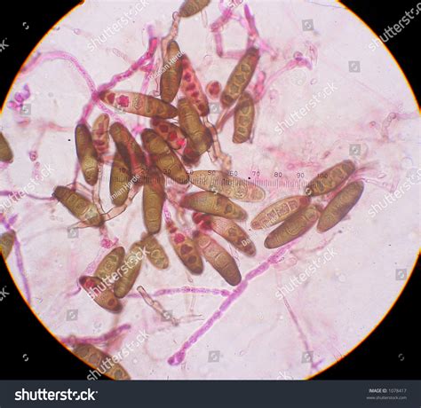 Fungal Spores Under The Microscope (Fungus Causes A Plant Disease ...