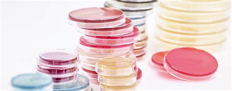 Nutrient Agar Plate- Know Your Media - Advancells Group