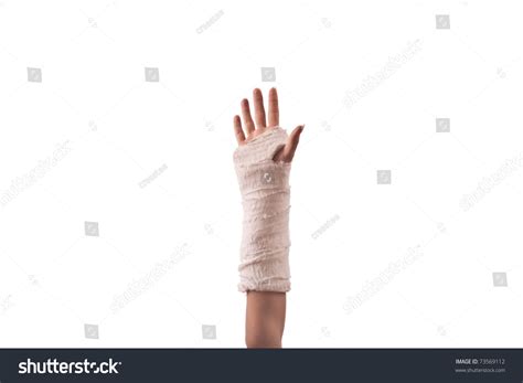 Broken Hand Cast Isolated On White Stock Photo 73569112 | Shutterstock