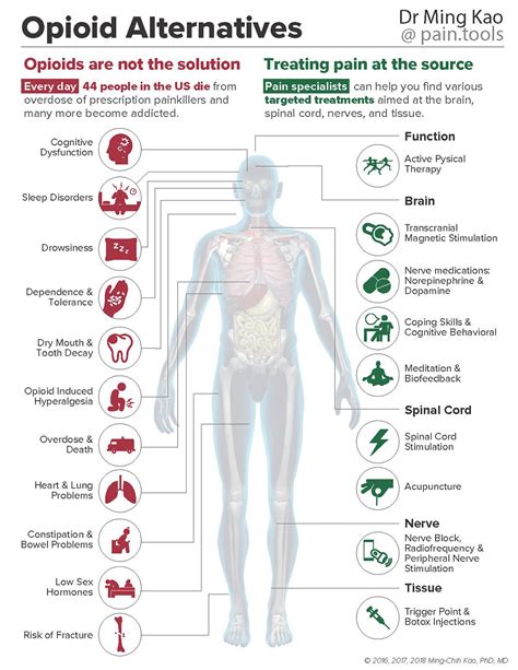 Opioid adverse effects & alternatives poster | by Stanford Pain ...