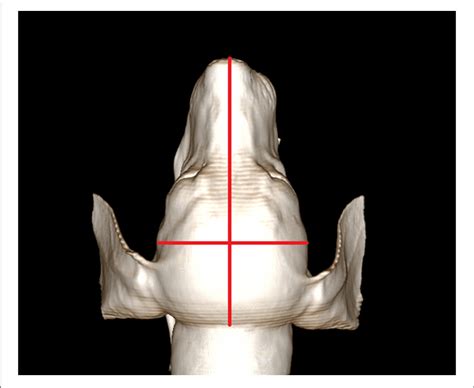 | Measurement of the cephalic index. For measuring the cephalic index ...