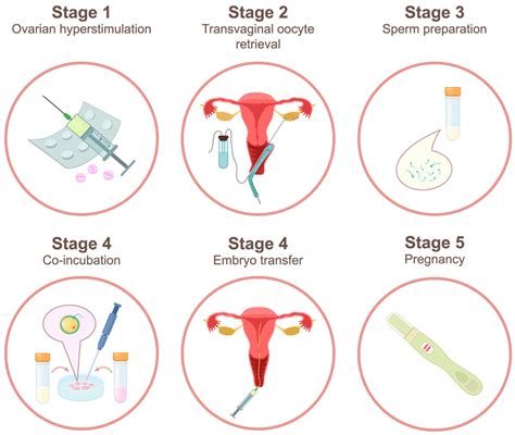 Egg Donor Process | Stork Surrogacy International