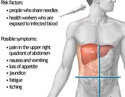 Autoimmune Hepatitis Causes Cirrhosis of the Liver - HealthProAdvice