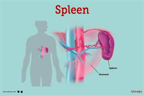 Enlarged Spleen (Splenomegaly): Symptoms, Causes Treatment, 44% OFF