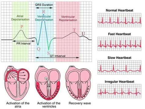 PHARMACO PLUS: ERRATIC HEART BEAT (ARRHYTHMIA)