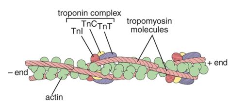 diagnosis of MI - newer biomarker troponin Flashcards | Quizlet