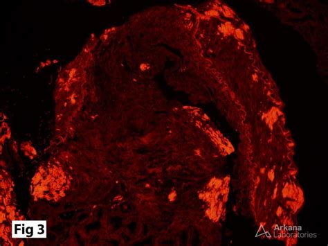 Congo Red Stain | Teaching Points | Arkana Laboratories