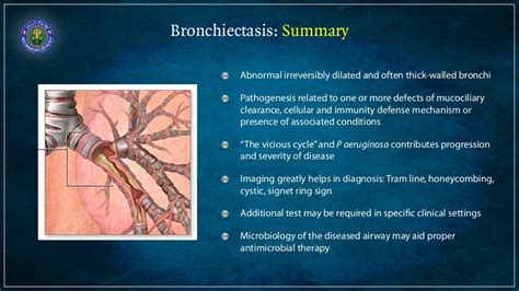 Bronchiectasis - causes and diagnosis