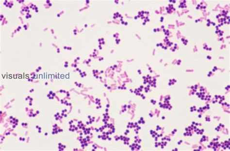 Gram staining procedure | Visuals Unlimited